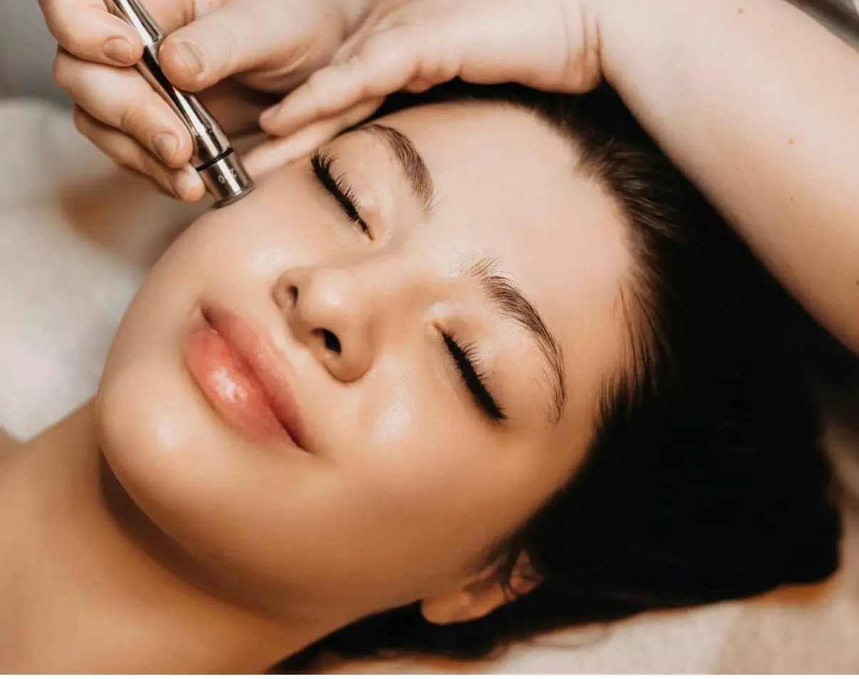 Microneedling